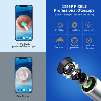 NE3 Ear Cleaner With Camera LED Light Wireless Ear Endoscope Ear Cleaning Kit For I-phone